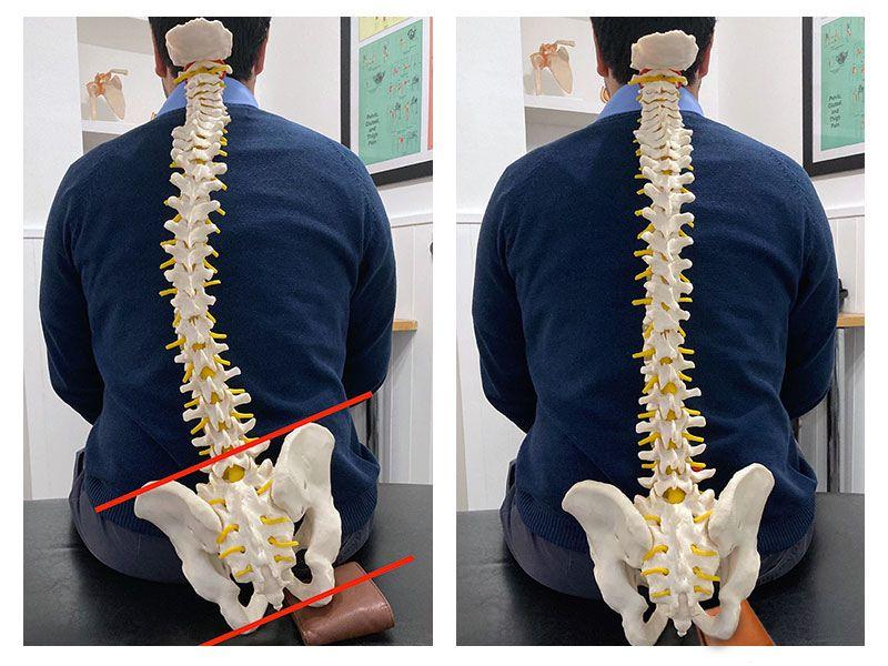 Assess-Improved posture